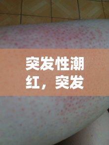 展翅高飞 第2页