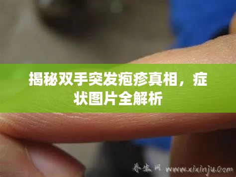 第314页